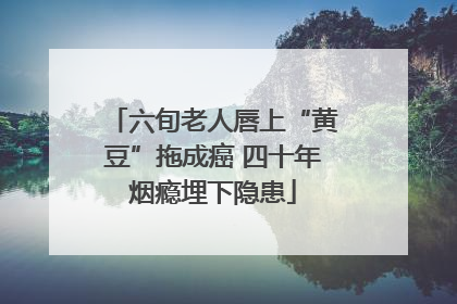 六旬老人唇上“黄豆”拖成癌 四十年烟瘾埋下隐患